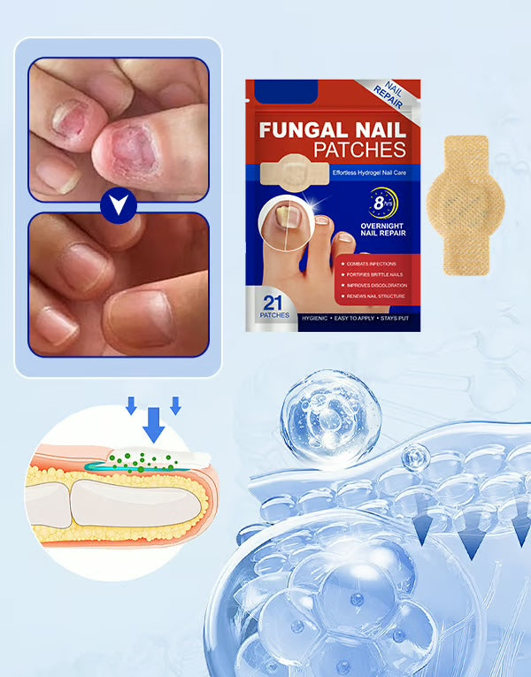 MycoPatch™ - Svampdödande nagelklistermärken