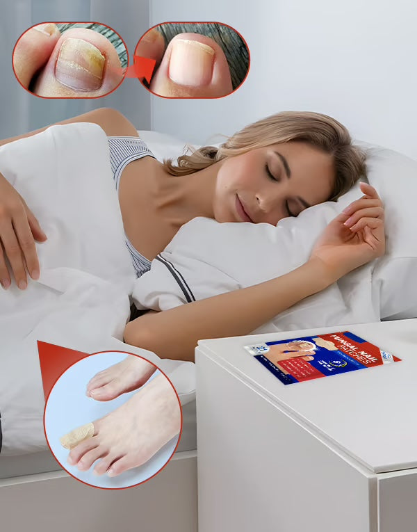MycoPatch™ - Svampdödande nagelklistermärken