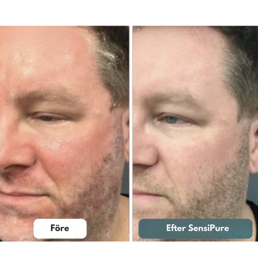 SensiPure Kräm