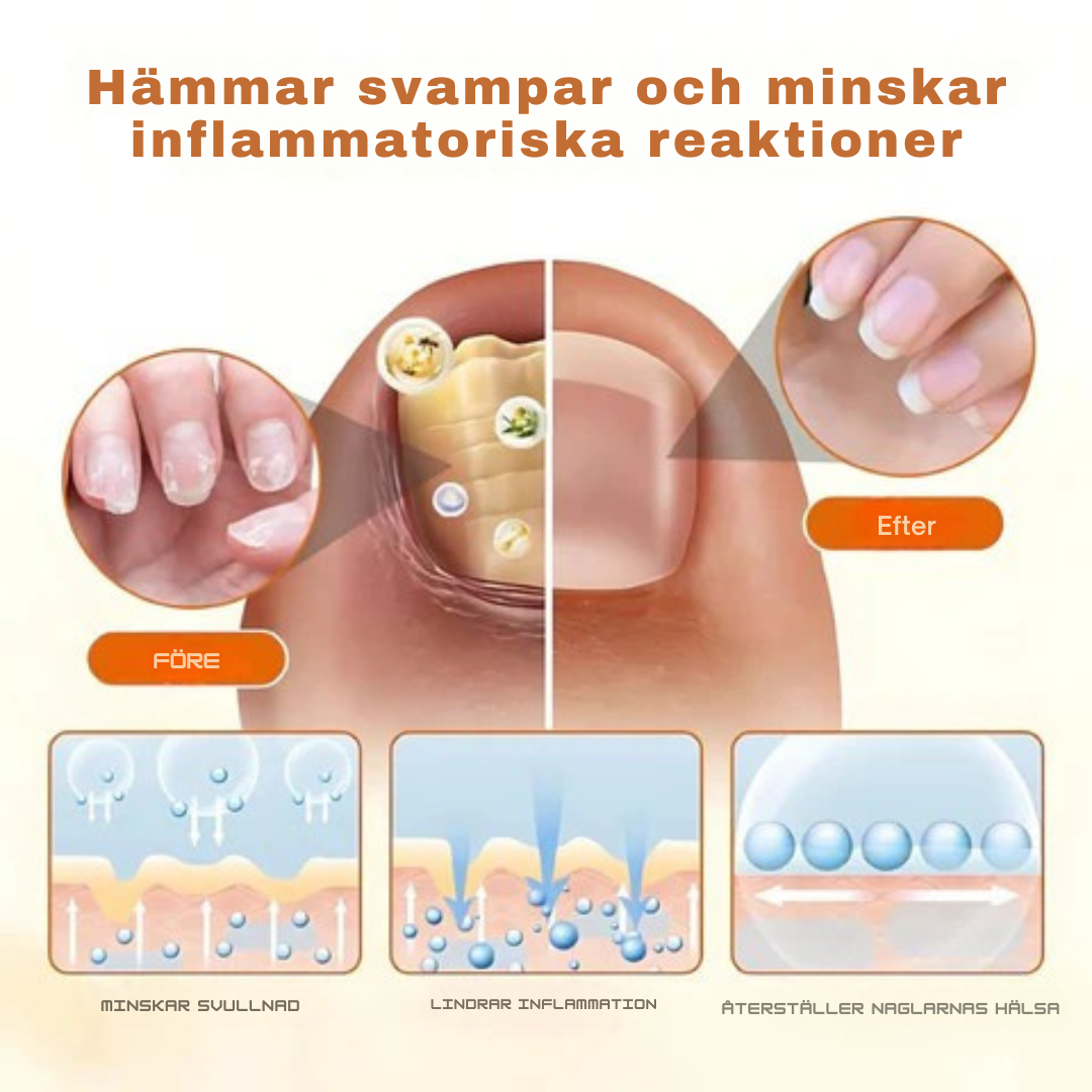 FungiFix™ – Avancerad svampdödande nagelvårdsspray