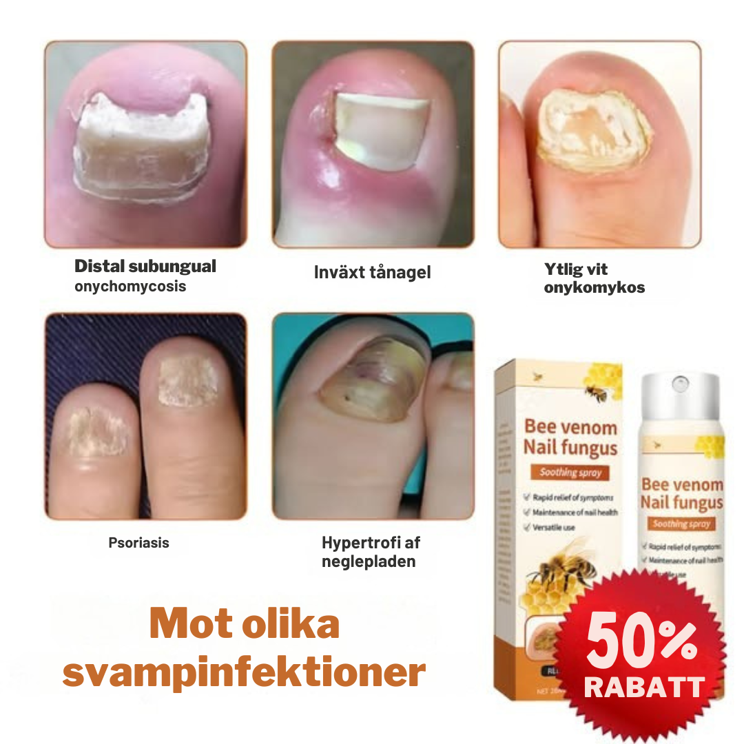 FungiFix™ – Avancerad svampdödande nagelvårdsspray