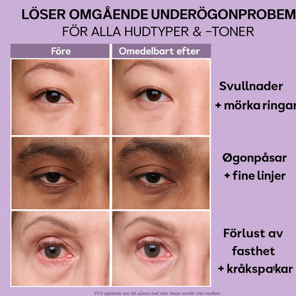 Ögonblickslyftet™ | Ögonkräm | Minskar påsar, svullnader och fina linjer på sekunder