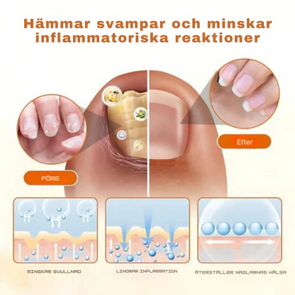 FungiFix™ – Avancerad svampdödande nagelvårdsspray